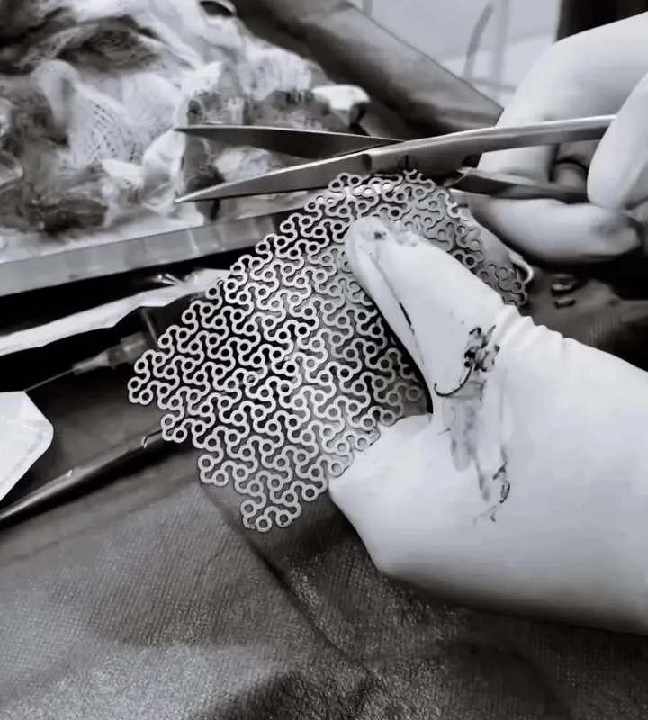 Cirurgia do Napoleão em preto e branco